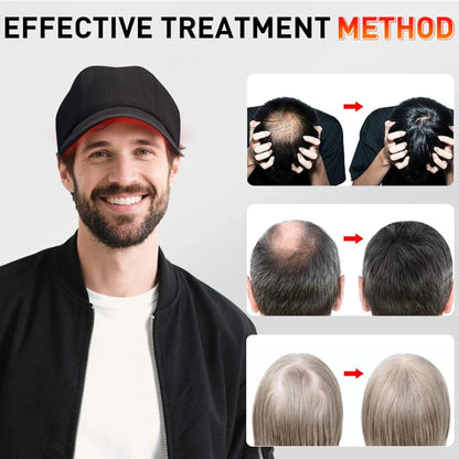 Red Light Hair Therapy Hat